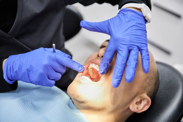 Best Emergency Treatment for Dental Infections or Abscesses in Warm Springs, CA