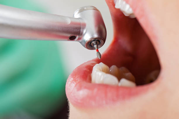 Best Pediatric Emergency Dentist in Warm Springs, CA
